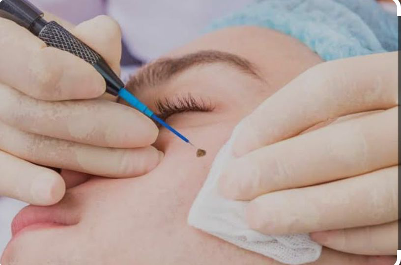 Procedure in progress